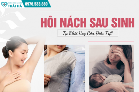 Hôi Nách Sau Sinh: Tự Khỏi Hay Cần Điều Trị?