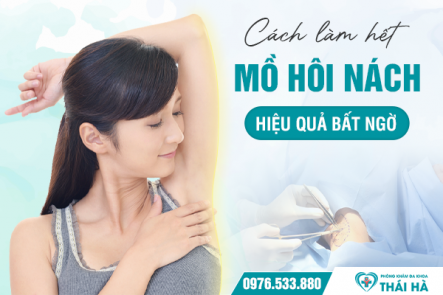 Cách làm hết mồ hôi nách hiệu quả bất ngờ