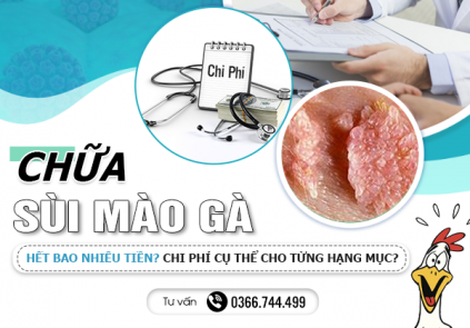 Chữa Bệnh Sùi Mào Gà Hết Bao Nhiêu Tiền? Chi Phí Cụ Thể Cho Từng Hạng Mục