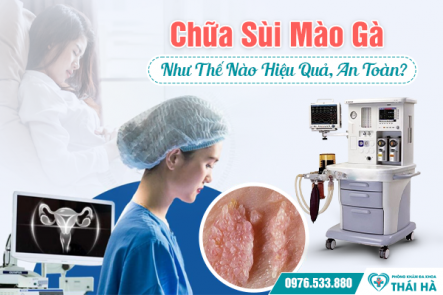 Chữa Sùi Mào Gà Như Thế Nào Hiệu Quả, An Toàn?