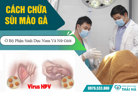 Cách Chữa Sùi Mào Gà Ở Bộ Phận Sinh Dục Nam Và Nữ Giới