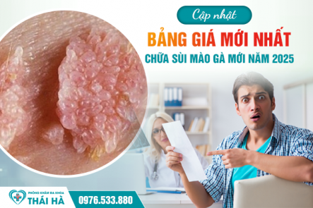 Cập Nhật Bảng Giá Chữa Sùi Mào Gà Mới Năm 2025