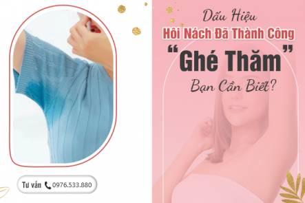 Dấu Hiệu Hôi Nách Đã Thành Công “Ghé Thăm”: Bạn Cần Biết?