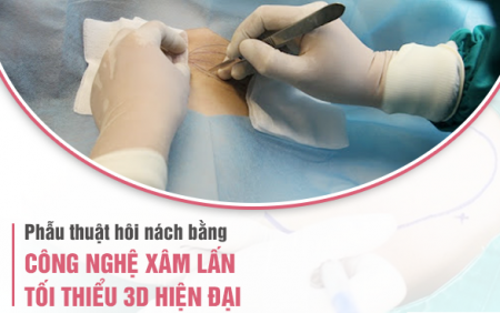 Phẫu thuật hôi nách bằng công nghệ xâm lấn tối thiểu 3D hiện đại