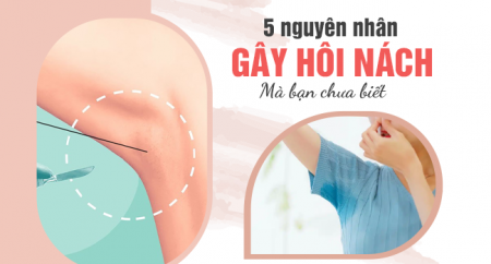 5 nguyên nhân gây hôi nách mà bạn chưa biết