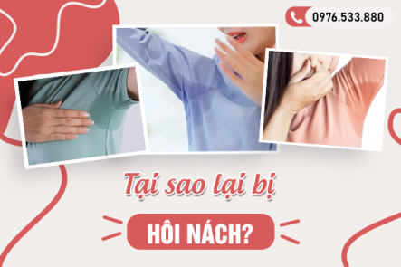 Tại sao lại bị hôi nách? Những bí mật bạn cần biết