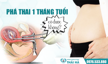 Phá thai 1 tháng tuổi có được không? Bật mí địa chỉ đình chỉ thai an toàn, không đau