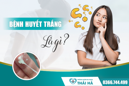 Bệnh huyết trắng là gì? - Cách trị bệnh huyết trắng