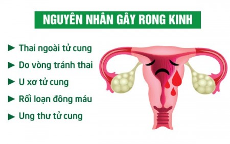 Rong kinh - Rong kinh là gì, có nguy hiểm không?