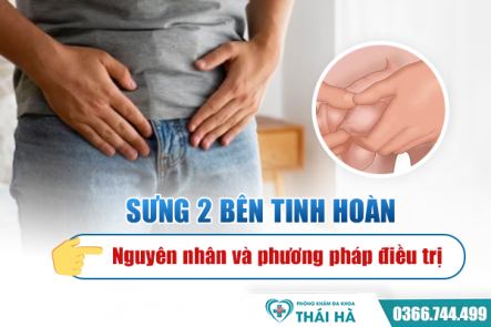 Sưng 2 bên tinh hoàn- Nguyên nhân và phương pháp điều trị