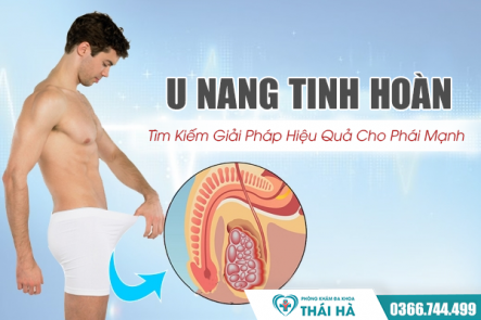 U Nang Tinh Hoàn Có Nguy Hiểm Không? Tìm Kiếm Giải Pháp Hiệu Quả Cho Phái Mạnh